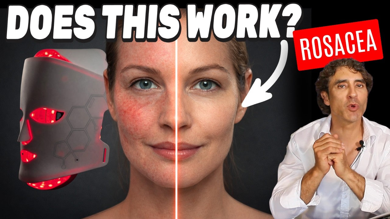Face Redness // The Truth About Led Masks