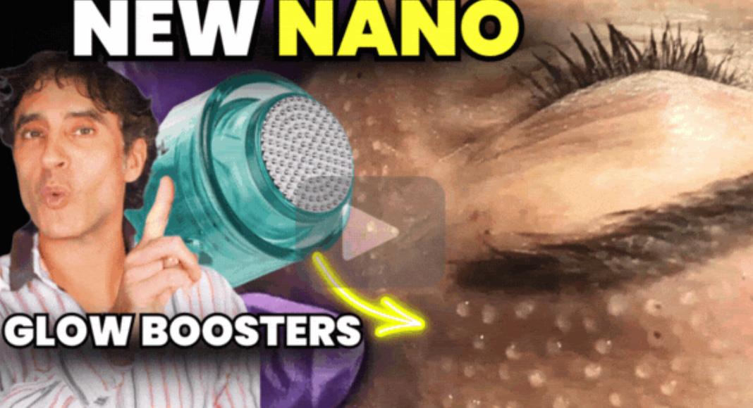 Look Years Younger in 20 Minutes (Flash Fillers) !!