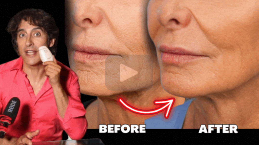 Your Best At Home Face Tightening Device Today