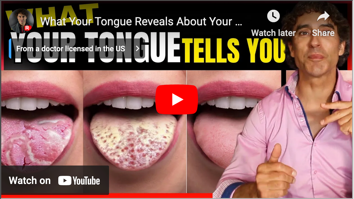 What Your Tongue Reveals About Your Health