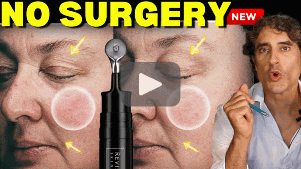 Look Younger with Youthful Eyes & Lifted Face !!