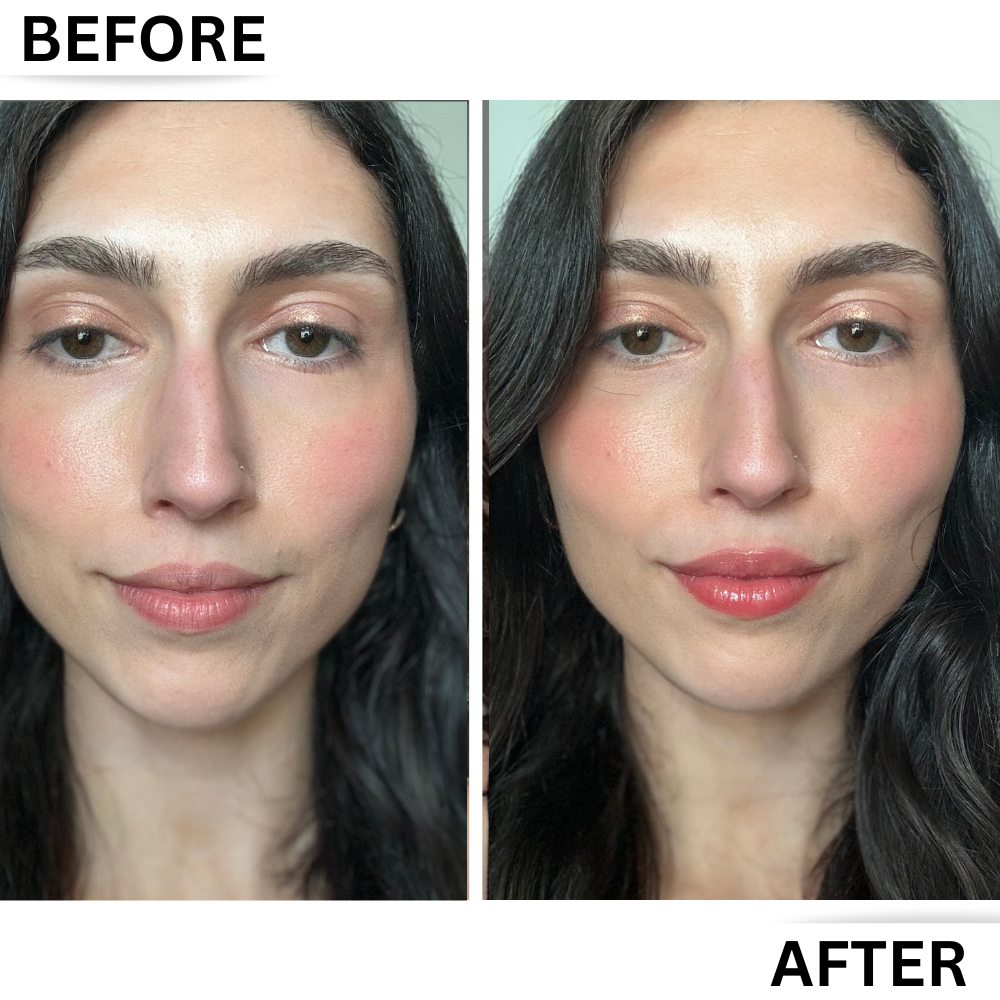 Lip Enhancer