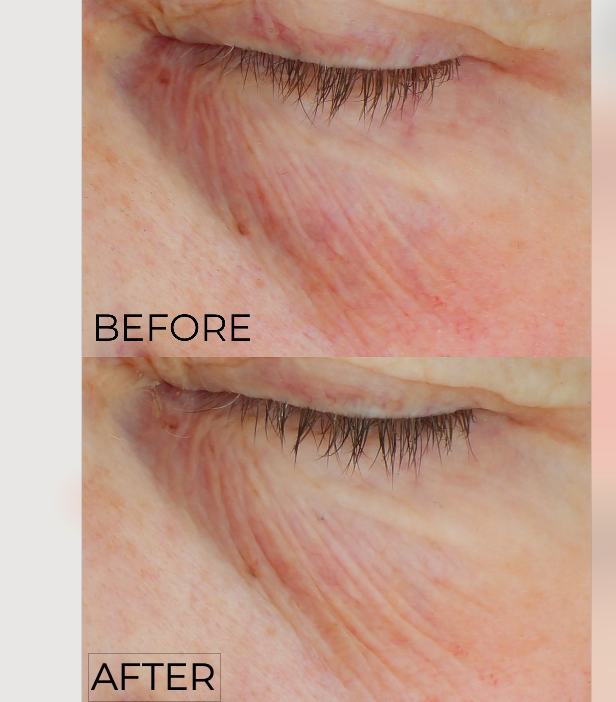 C+ Brightening Eye Complex