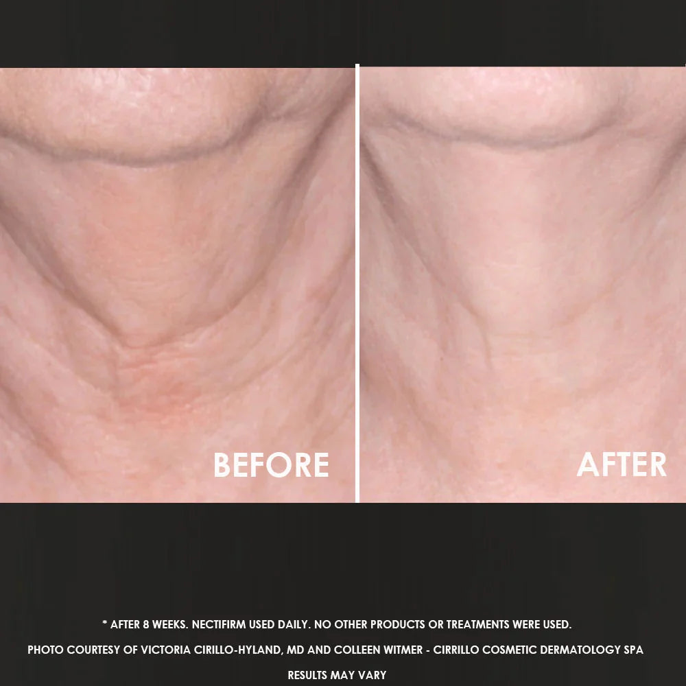 Neck Firming Potion