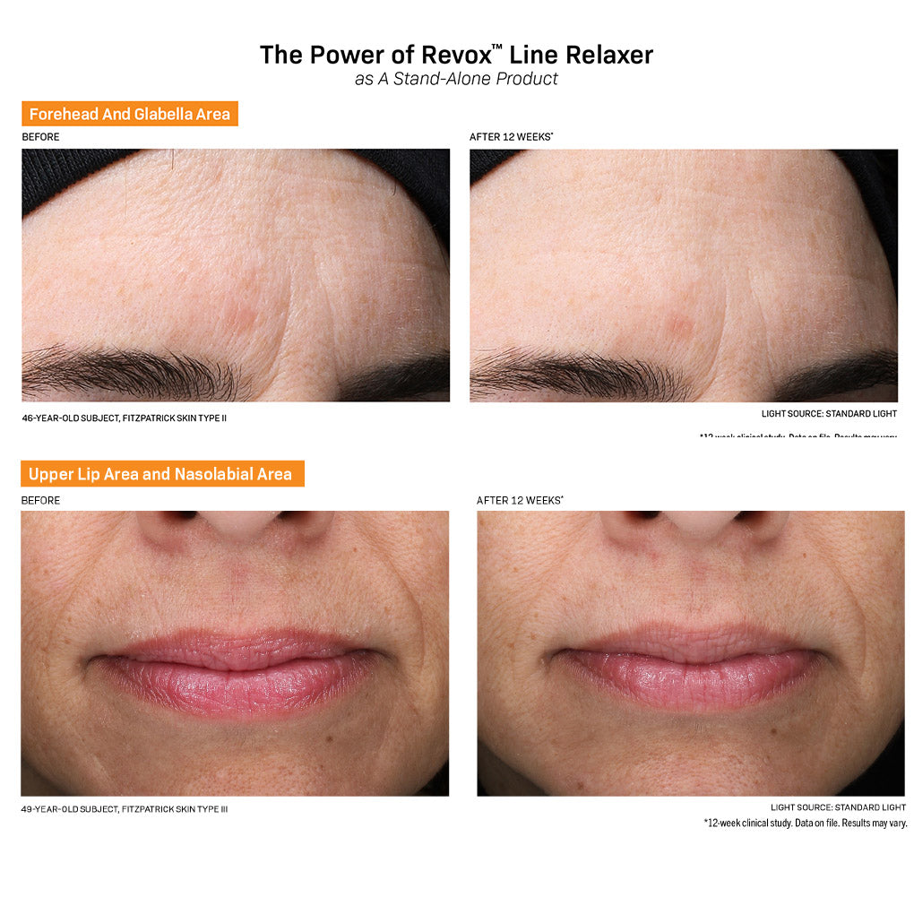 Revox Line Relaxer™