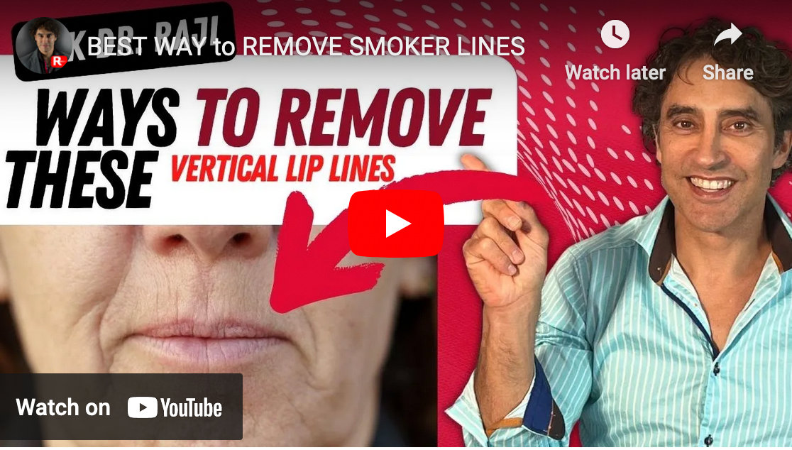 BEST WAY to REMOVE SMOKER LINES
