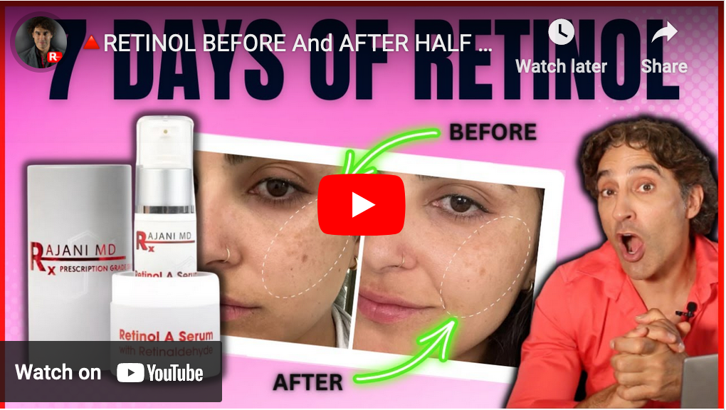 RETINOL BEFORE and AFTER HALF of HER FACE