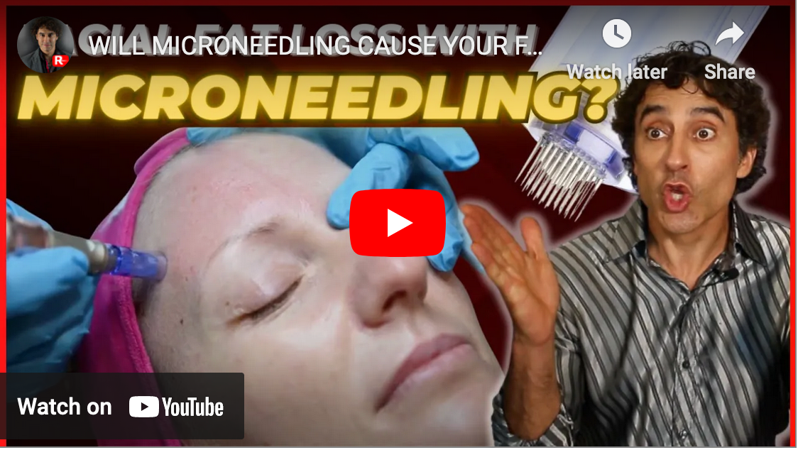 WILL MICRONEEDLING CAUSE YOUR FACIAL FAT LOSS and DAMAGE YOUR SKIN