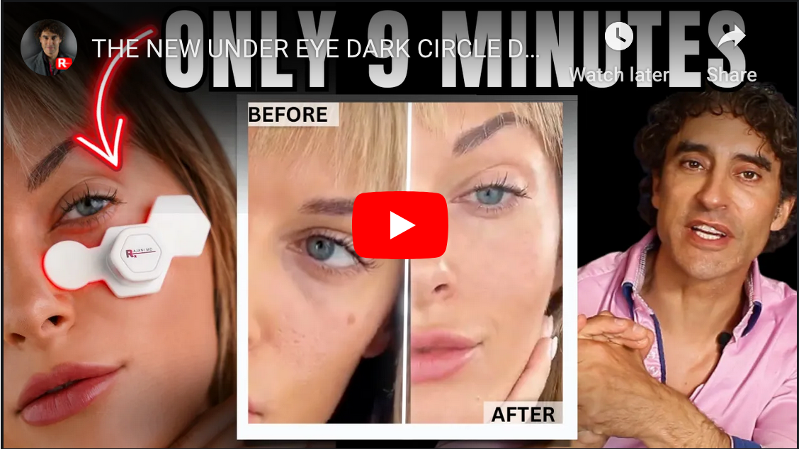 How to Get Rid of Puffy Eye Bags at Home: Advanced Solutions for 2025