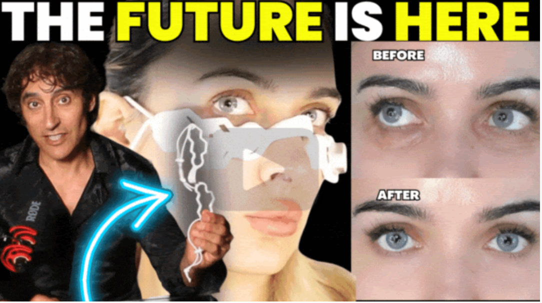 Under Eye Tightening and Brightening