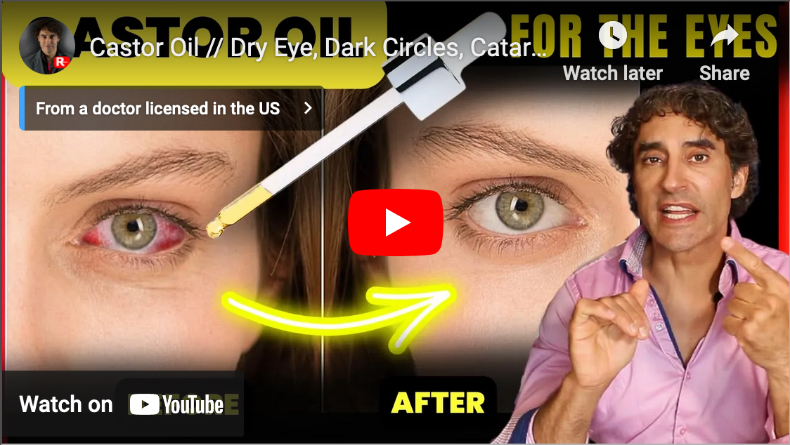 Castor Oil // Dry Eye, Dark Circles, Cataracts, Floaters and MORE!!