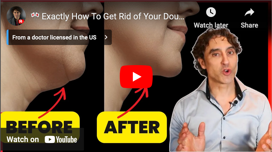 Exactly How To Get Rid of Your Double Chin For Good // A 2024 Update