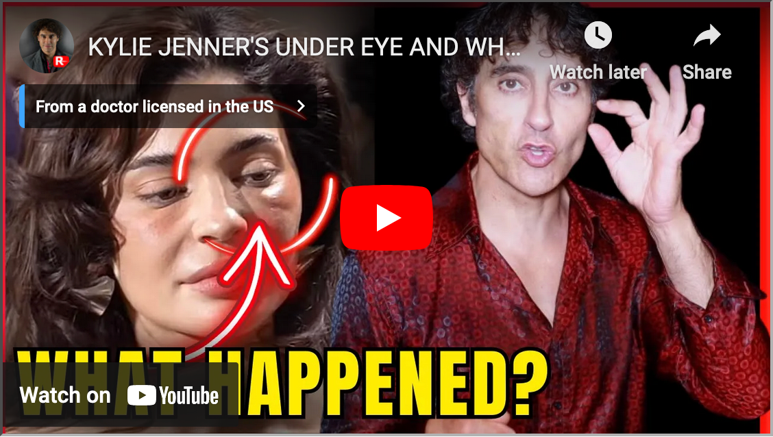 KYLIE JENNER'S UNDER EYE AND WHAT WE CAN LEARN
