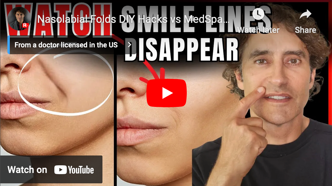 Nasolabial Folds DIY Hacks vs MedSpa Solutions