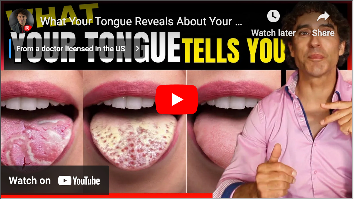 What Your Tongue Reveals About Your Health !!
