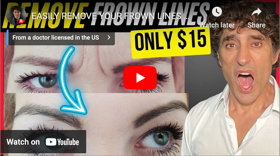 EASILY REMOVE YOUR FROWN LINES AT HOME FOR UNDER $15