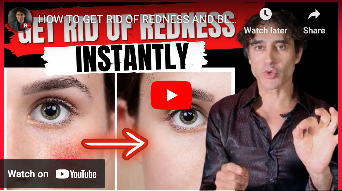 HOW TO GET RID OF REDNESS AND BLOOD VESSELS ON THE FACE