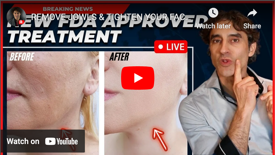 REMOVE JOWLS & TIGHTEN YOUR FACE WITHOUT SURGERY -Everything You Need To Know NEW Approved Procedure