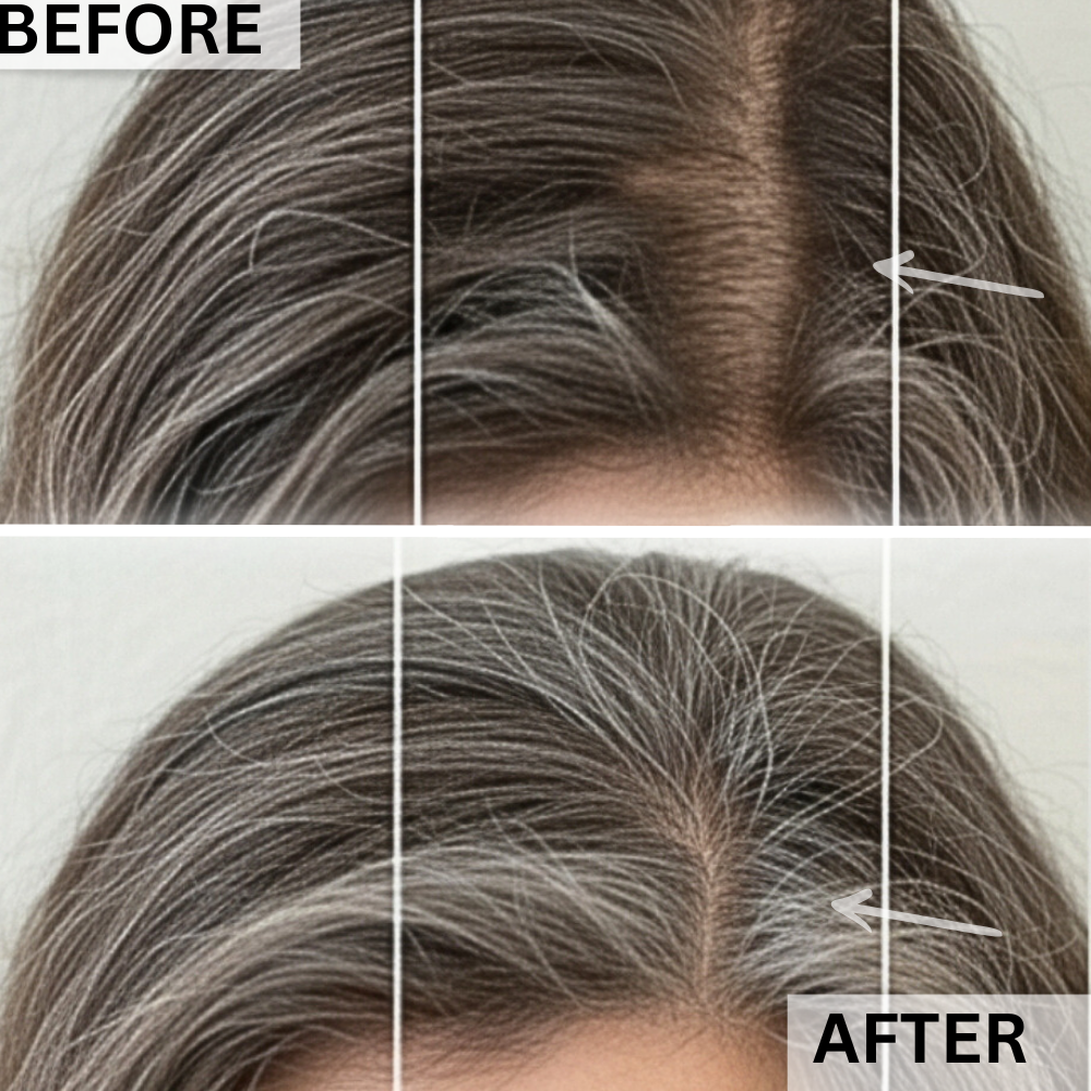 Before and after image showing PlasmaGLO Halo LED mask results on face neck and hair