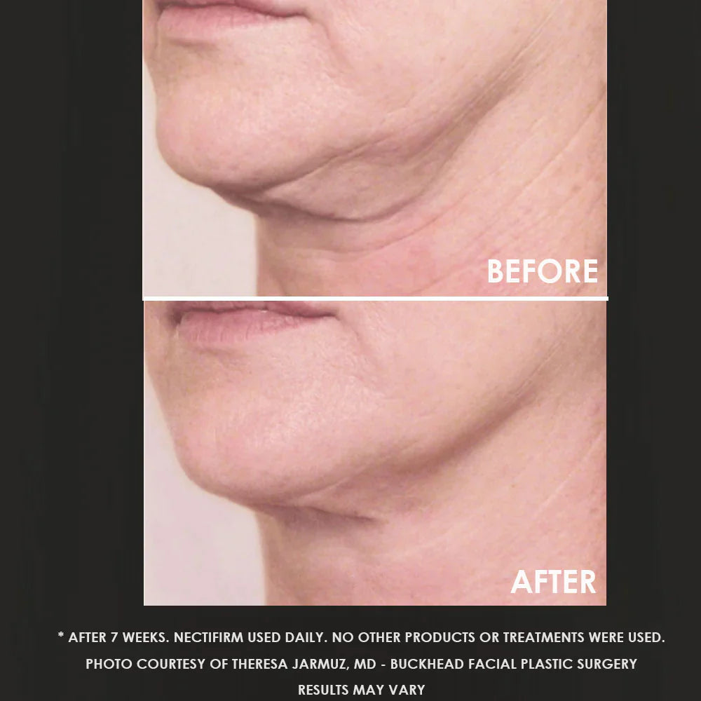 Neck Firming Potion