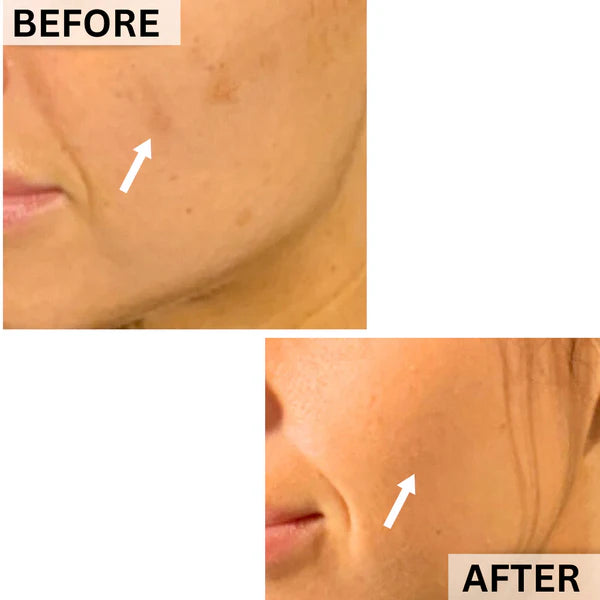 before and after 2