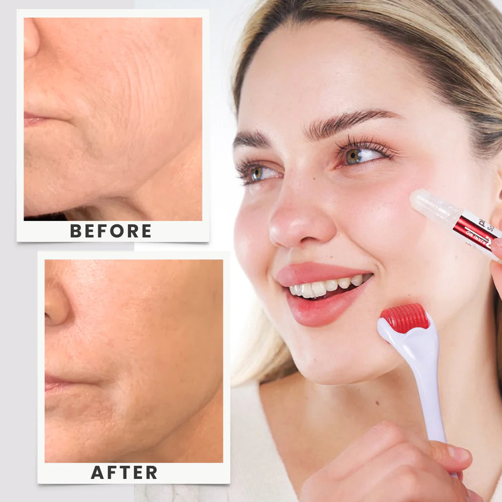 Before and after showing Clinical-Level Skin Transformation at Home with the RajaniMD plasmaSOMES™ At-home Microneedle Kit