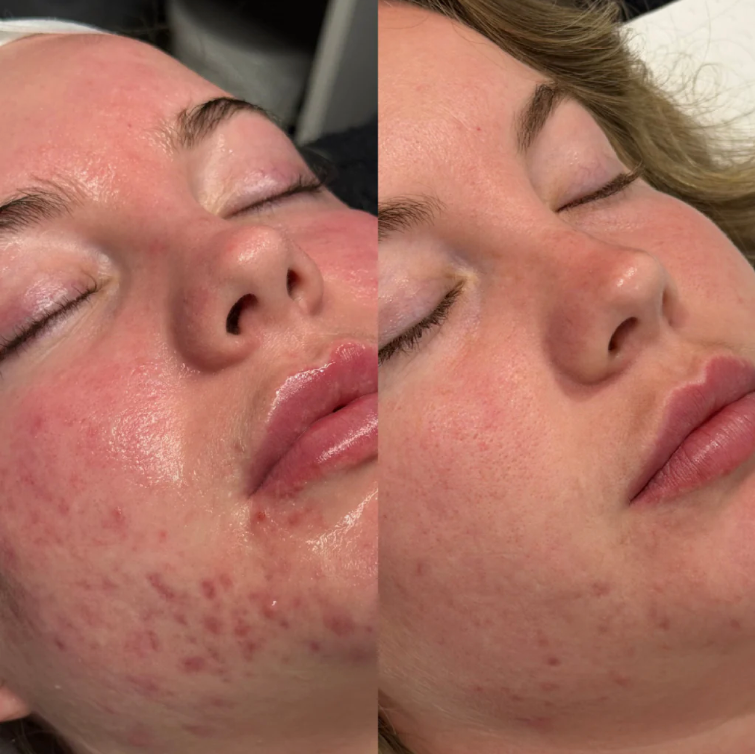 Revitalizing Spicule Boosting Serum