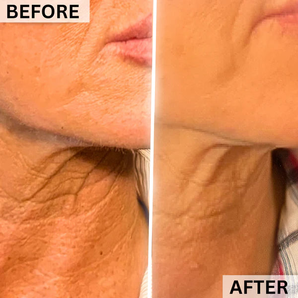 before and after 1