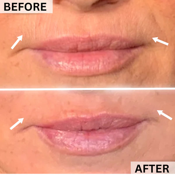 before and after 3