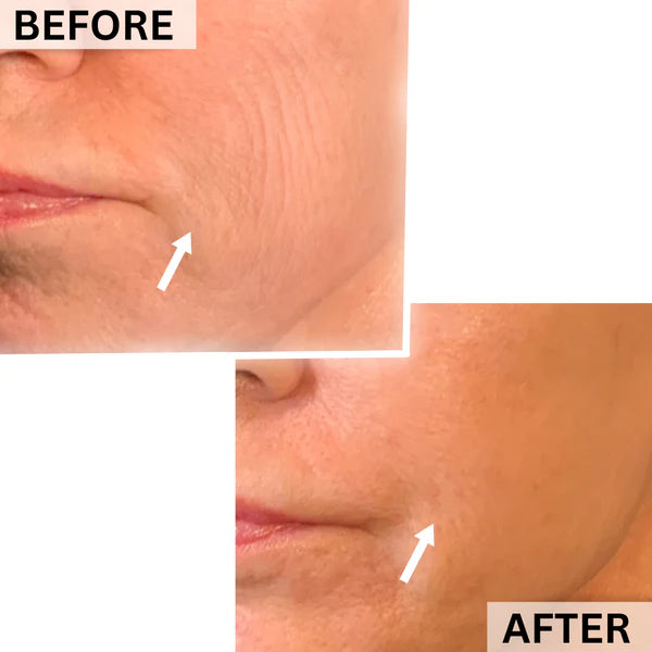 before and after 4