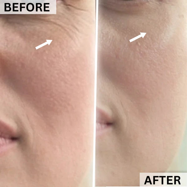 before and after 5
