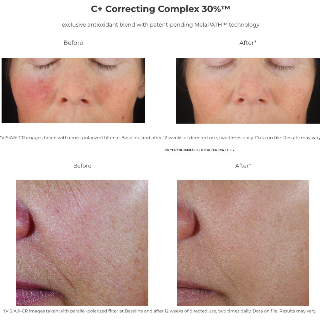 C+ Correcting Complex 30%