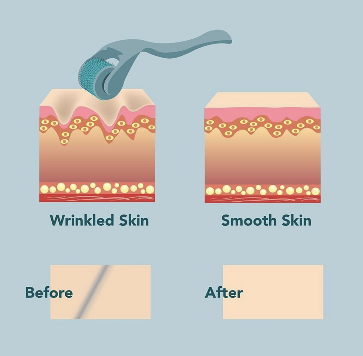 Home Microneedling Intro System Enhance Your Skin’s Healing Response