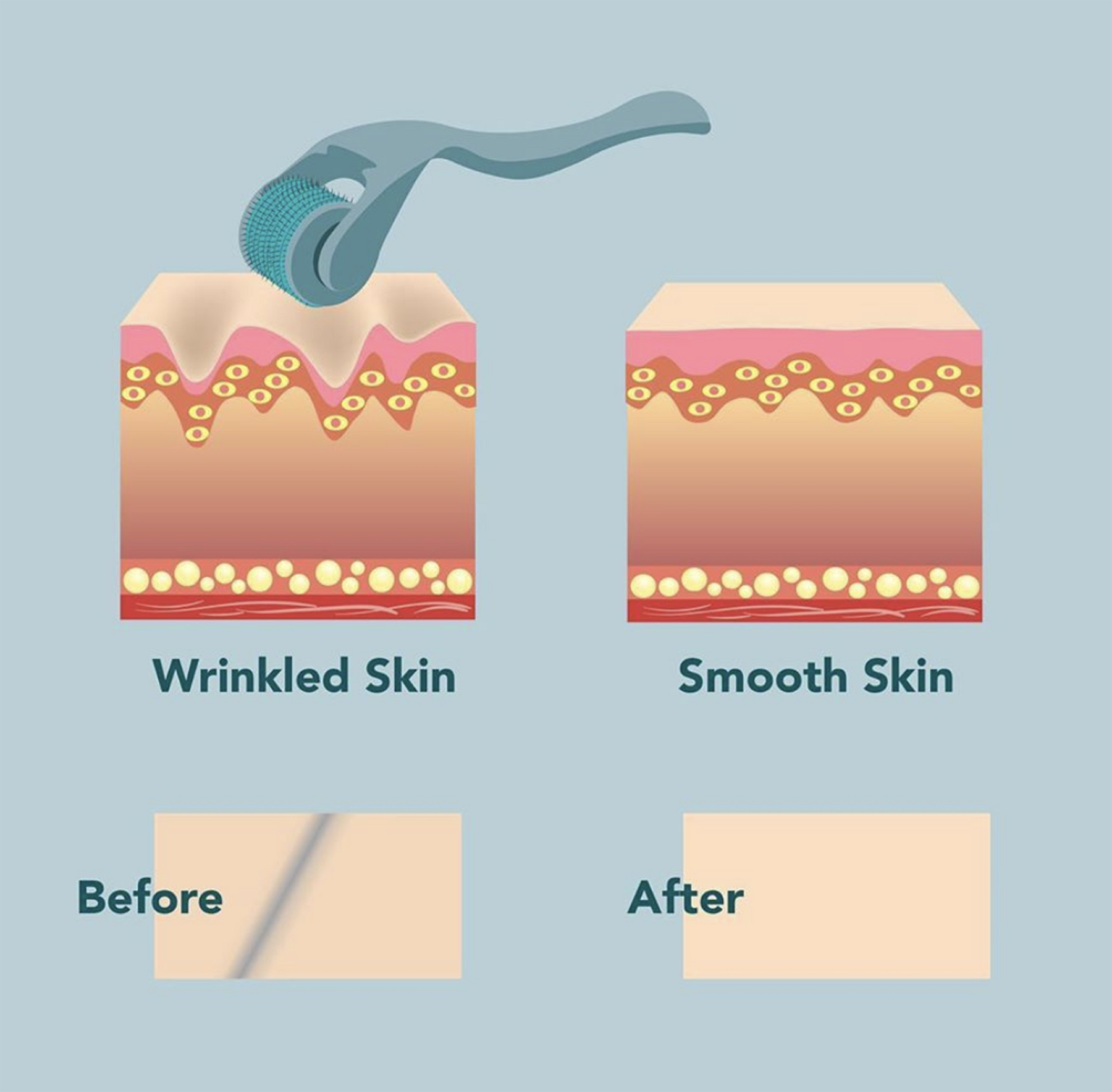 Home Microneedling Intro System
