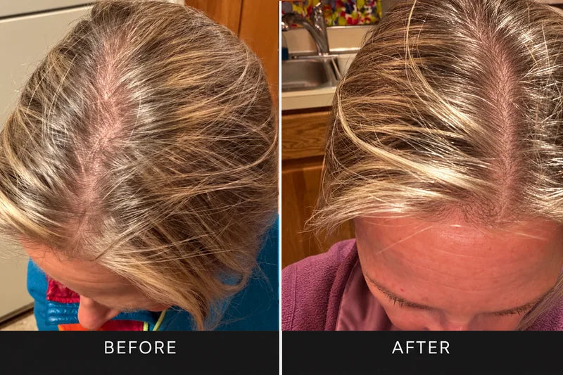 Before and after: top of a woman's head, the part line looks fuller after
