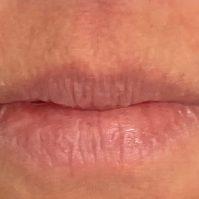 Lips, after 4 weeks of use