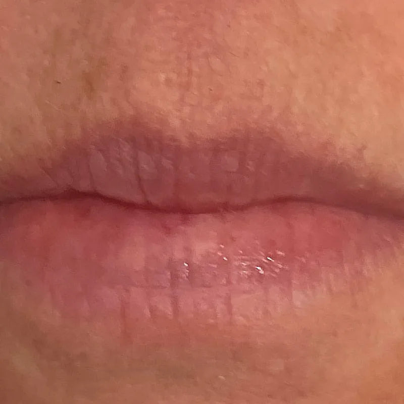 Lips, before